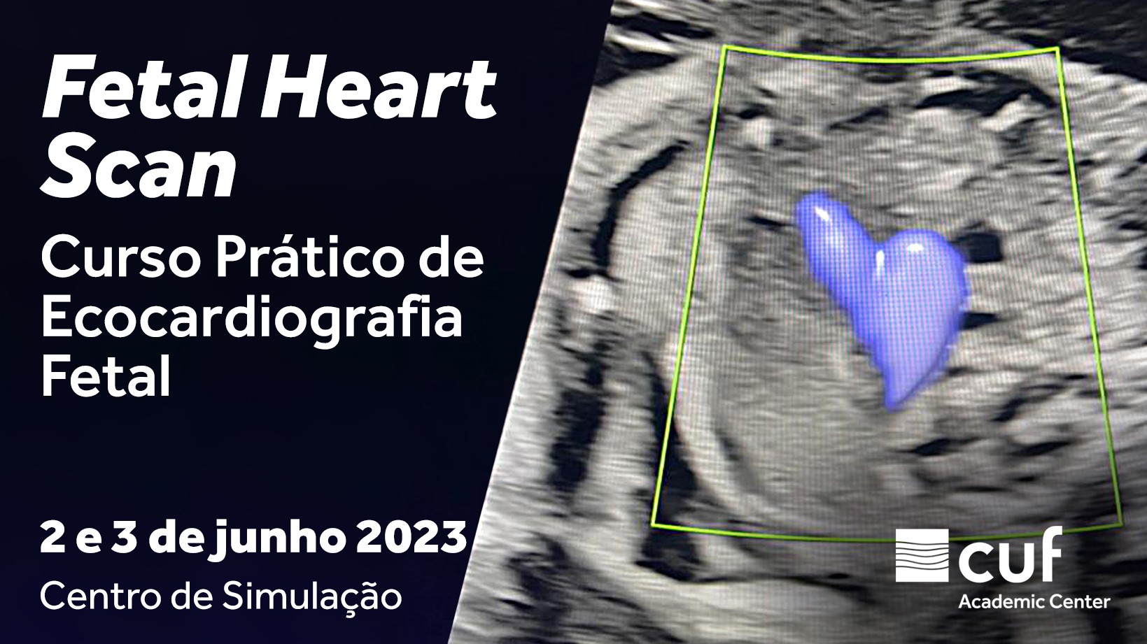 Fetal Heart Scan - Curso Prático de Ecocardiografia Fetal